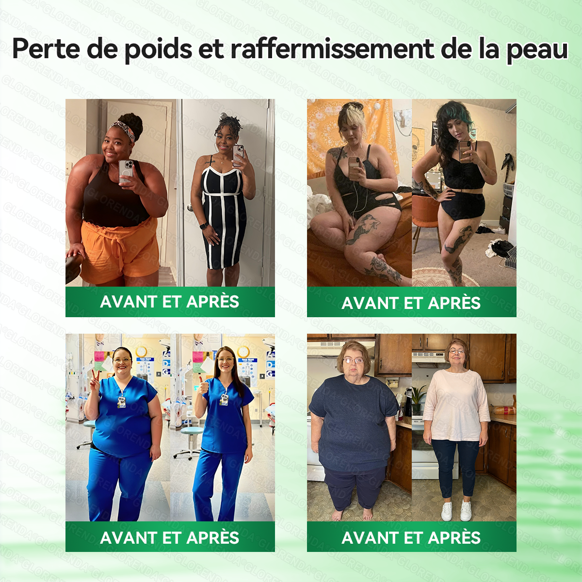𝐁𝐨𝐮𝐭𝐢𝐪𝐮𝐞 𝐎𝐟𝐟𝐢𝐜𝐢𝐞𝐥𝐥𝐞 𝐅𝐫𝐚𝐧𝐜𝐞 🌿 𝐂𝐥𝐞𝐚𝐫𝐞𝐧𝐚® 𝐏𝐚𝐭𝐜𝐡 𝐌𝐢𝐧𝐜𝐞𝐮𝐫 𝟏𝟎-𝐞𝐧-𝟏 (𝟏×/𝐣𝐨𝐮𝐫, 𝐫𝐞́𝐬𝐮𝐥𝐭𝐚𝐭𝐬 𝐯𝐢𝐬𝐢𝐛𝐥𝐞𝐬 𝐞𝐧 𝟕 𝐣𝐨𝐮𝐫𝐬) | 𝐎𝐛𝐞́𝐬𝐢𝐭𝐞́, 𝐫𝐞𝐥𝐚̂𝐜𝐡𝐞𝐦𝐞𝐧𝐭 𝐜𝐮𝐭𝐚𝐧𝐞́, 𝐚𝐩𝐧𝐞́𝐞 𝐝𝐮 𝐬𝐨𝐦𝐦𝐞𝐢𝐥, 𝐚𝐫𝐭𝐢𝐜𝐮𝐥𝐚𝐭𝐢𝐨𝐧𝐬, 𝐞𝐭𝐜.